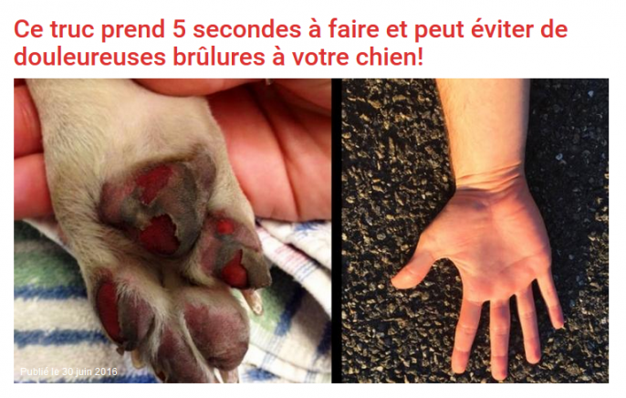 Brulures